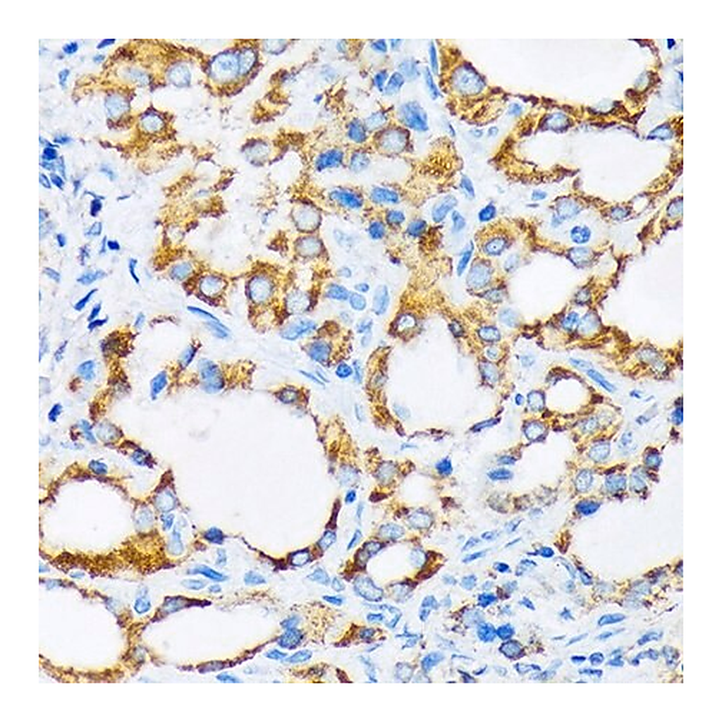 Merck Anti-PIST/GOPC antibody produced in rabbit