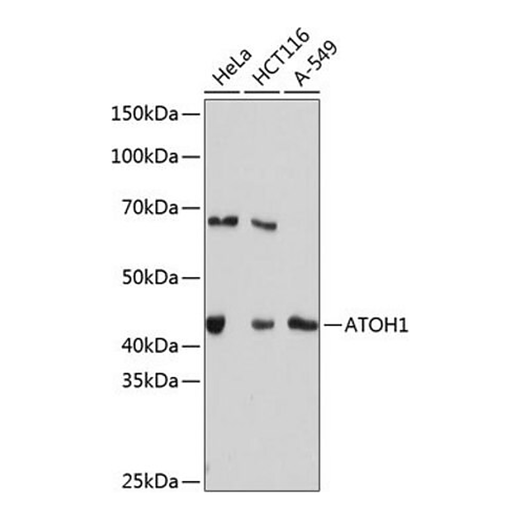 Merck Anti-ATOH1 antibody produced in rabbit
