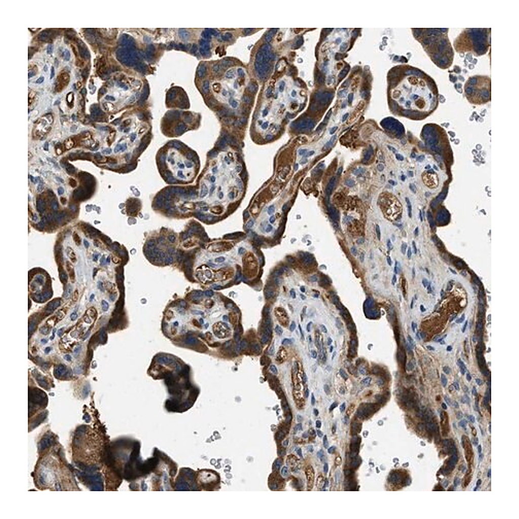 Merck Anti-RIPK2 antibody produced in rabbit