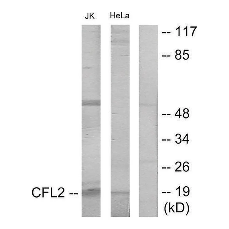 Merck Anti-Cofilin antibody produced in rabbit