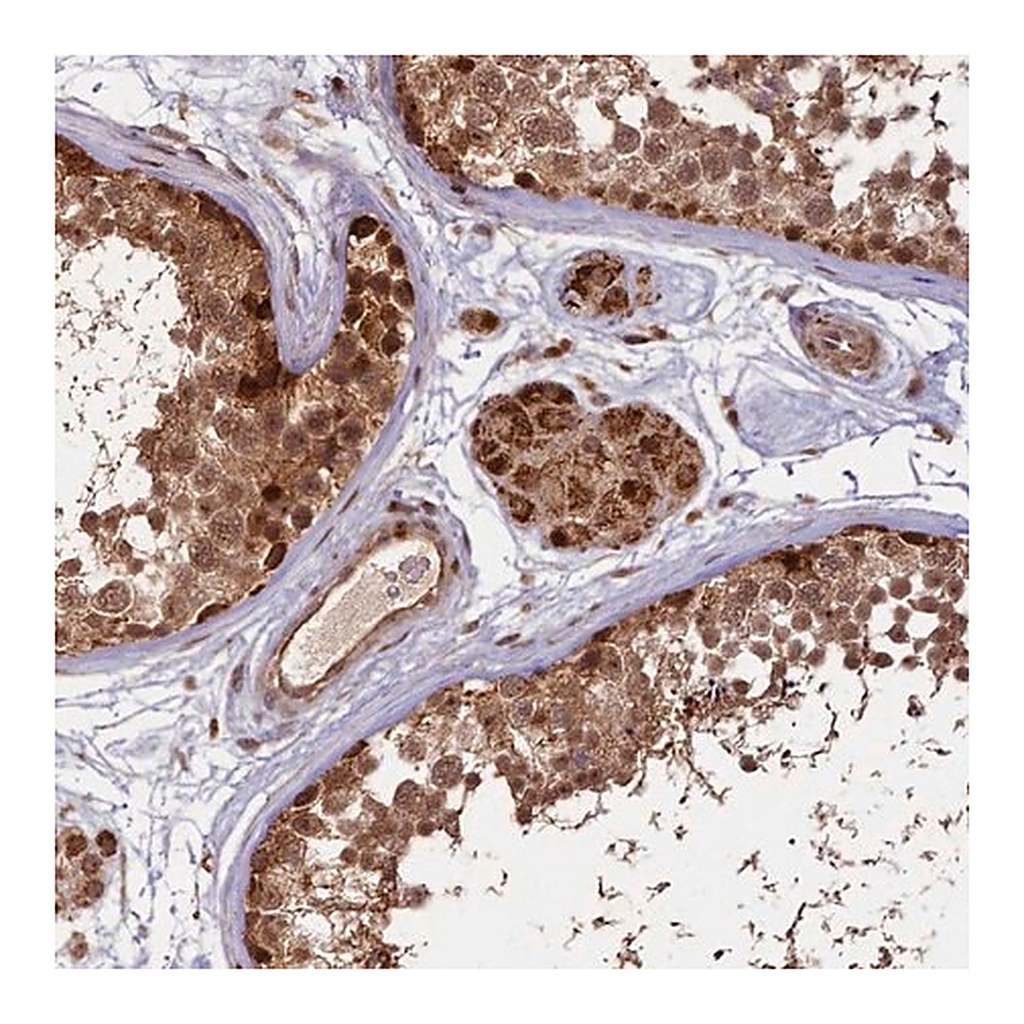 Merck Anti-SHPRH antibody produced in rabbit
