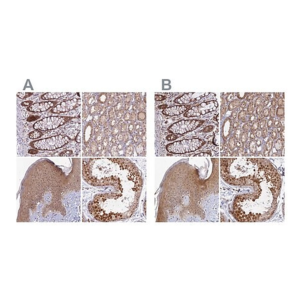 Merck Anti-WDR61 antibody produced in rabbit