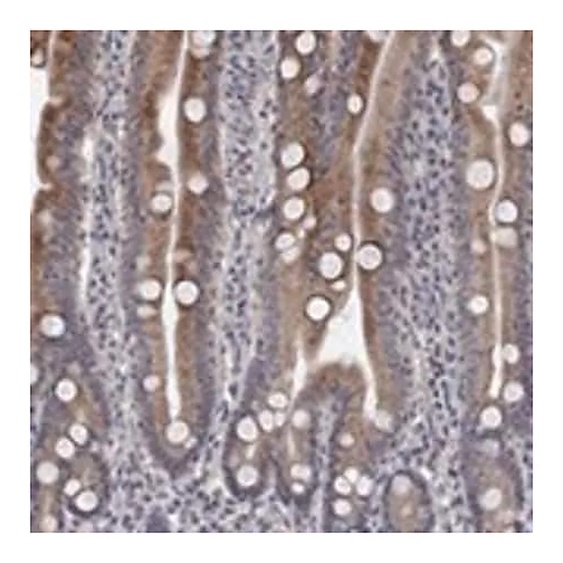 Merck Anti-UNC5B antibody produced in rabbit