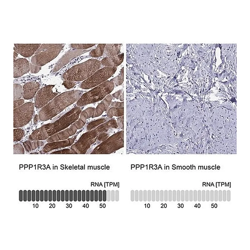 Merck Anti-PPP1R3A antibody produced in rabbit