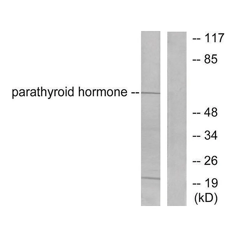 Merck Anti-Parathyroid Hormone antibody produced in rabbit