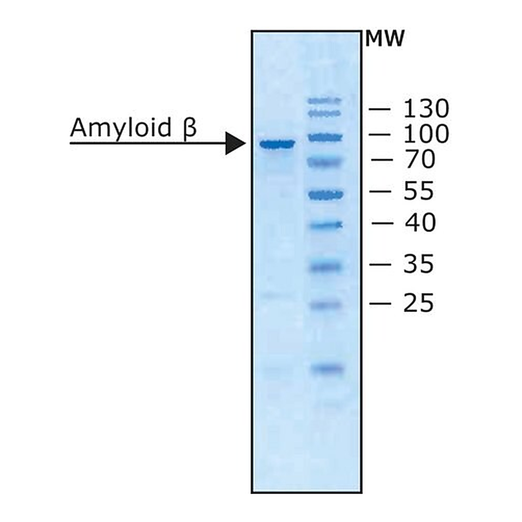 Merck Amyloid Precursor Protein beta, Secreted human