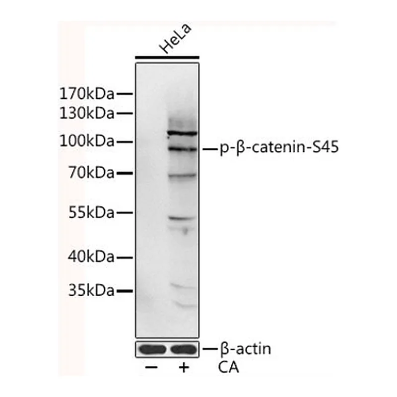 Merck ANTI-PHOSPHO-CTNNB1-S45 ANTIBODY PRODUC&