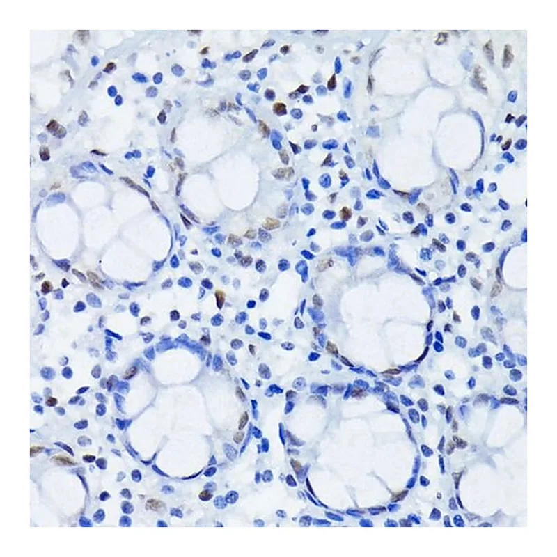 Merck Anti-HIF1beta/ARNT antibody produced in rabbit