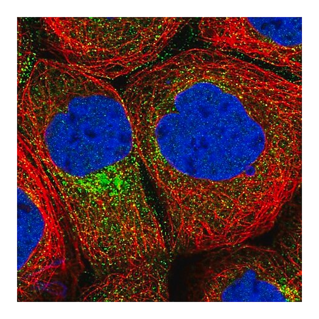Merck Anti-CPEB4 antibody produced in rabbit
