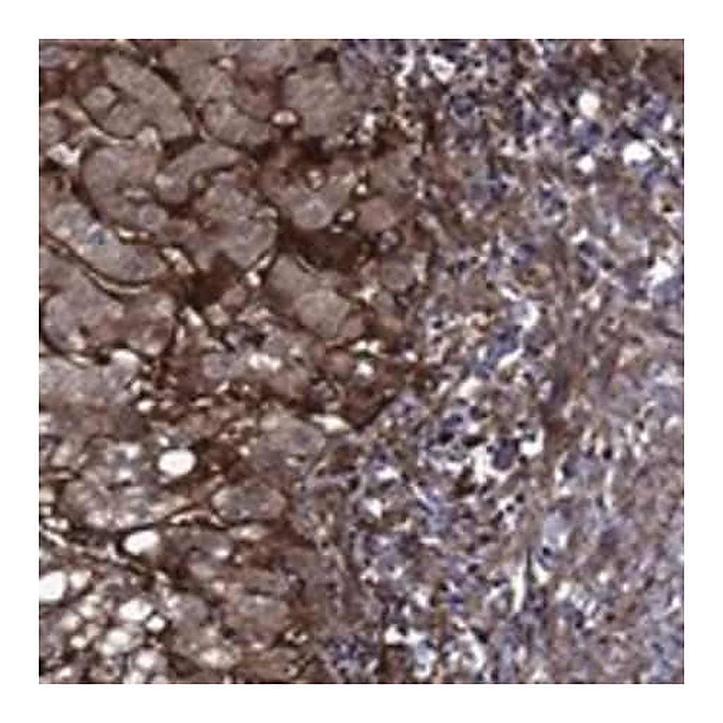 Merck Anti-COL18A1 antibody produced in rabbit