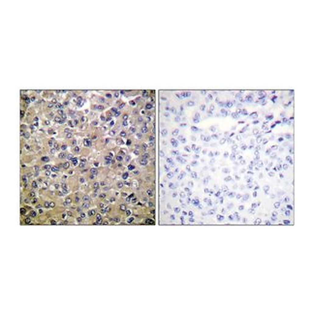 Merck ANTI-PP1-? ANTIBODY PRODUCED IN RABBIT