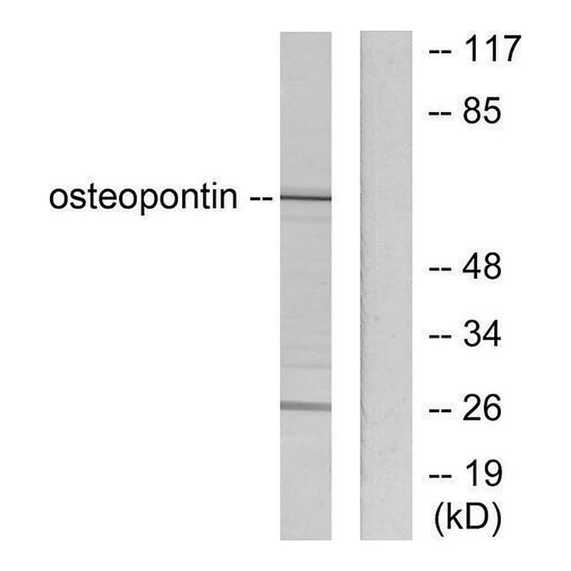 Merck Anti-Osteopontin, C-Terminal antibody produced in rabbit
