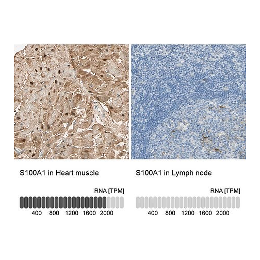 Merck Anti-S100A1 antibody produced in rabbit