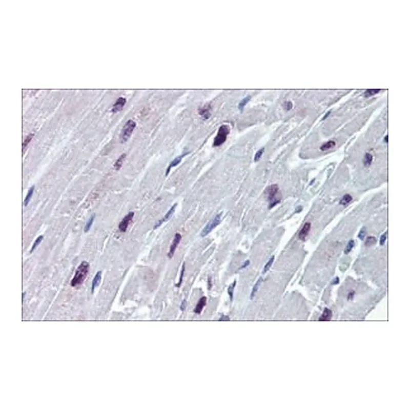 Merck Anti-SOX4