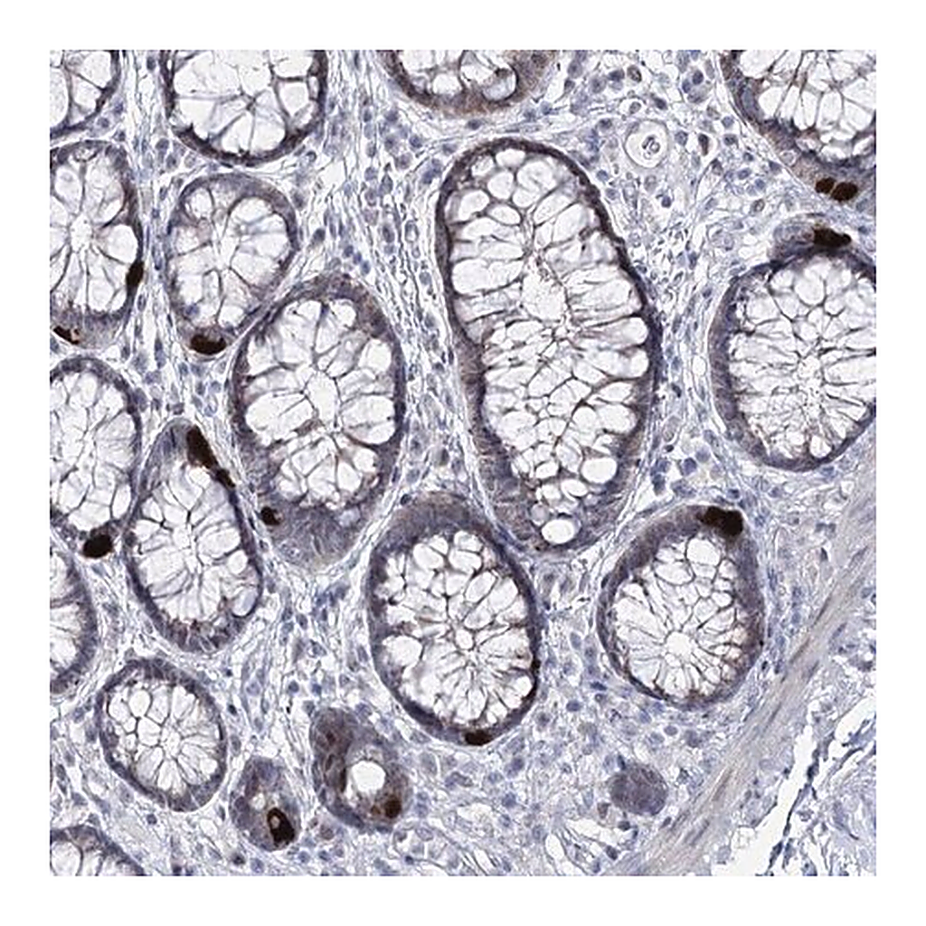 Merck Anti-RBM15B antibody produced in rabbit