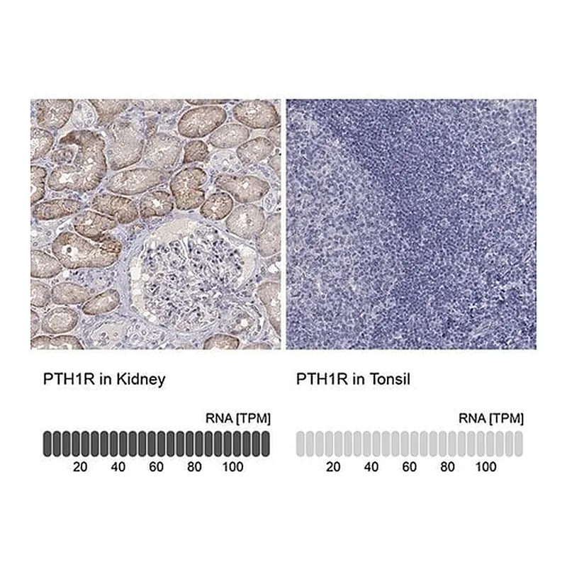 Merck Anti-PTH1R antibody produced in rabbit