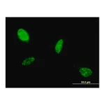 Merck Monoclonal Anti-ATOH1 antibody produced in mouse