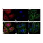 Thermo Fisher Scientific Goat anti-Rabbit IgG (H+L) Cross-Adsorbed Secondary Antibody, DyLight 594