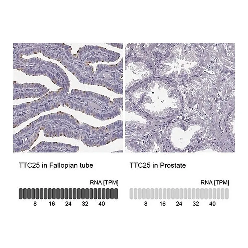 Merck ANTI-TTC25