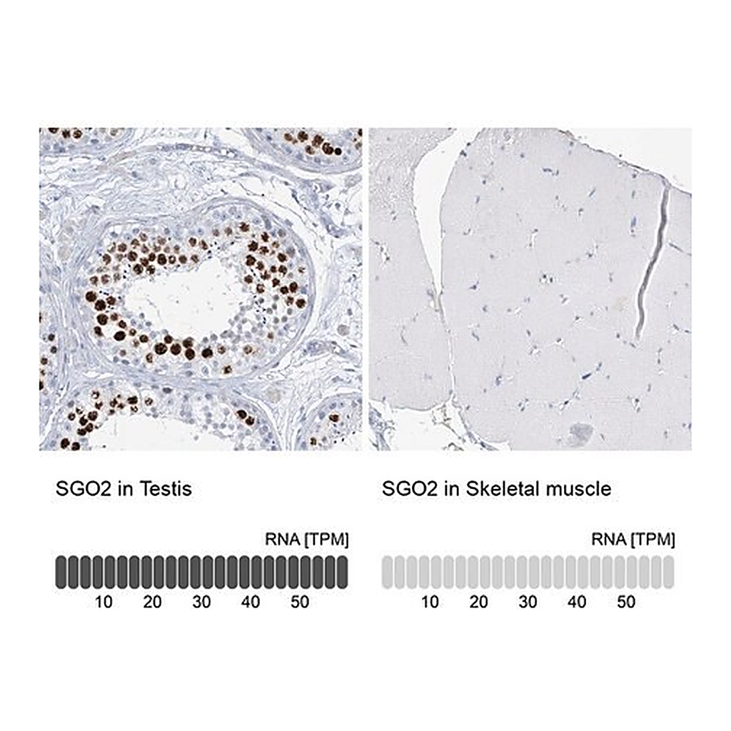 Merck Anti-SGO2 antibody produced in rabbit