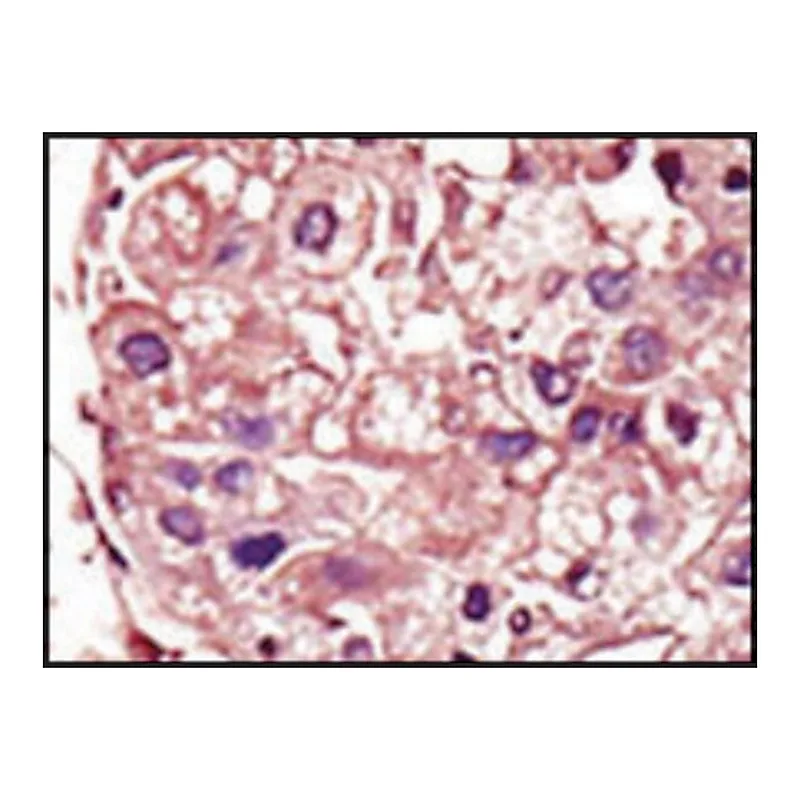 Merck Anti-TGFBR1 (center) antibody produced in rabbit