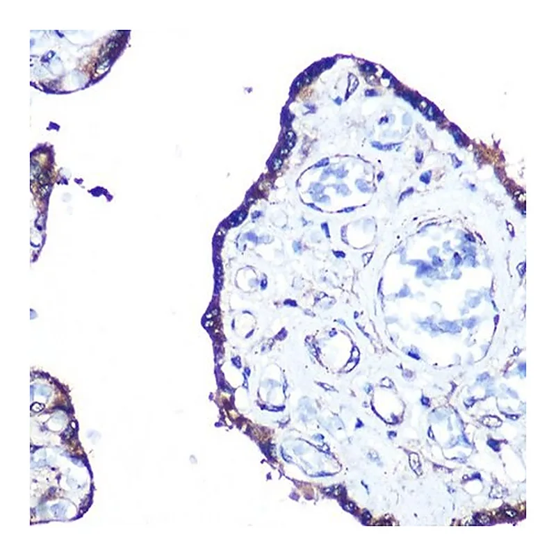 Merck Anti-MAP1LC3A antibody produced in rabbit