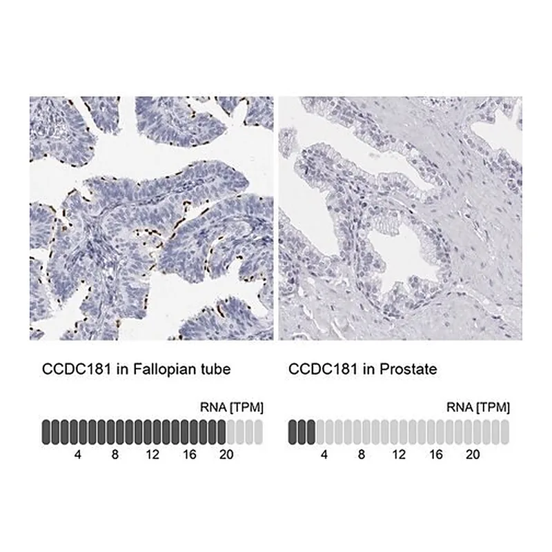 Merck Anti-CCDC181 antibody produced in rabbit