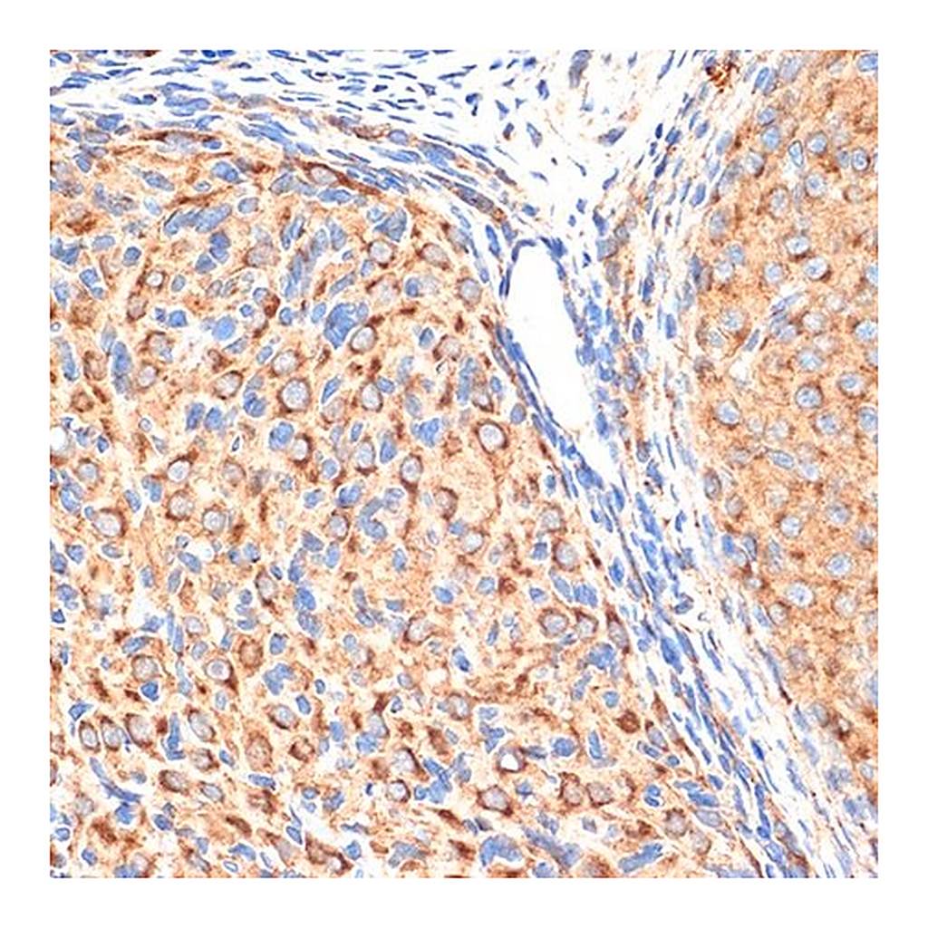 Merck Anti-AP1G1 antibody produced in rabbit