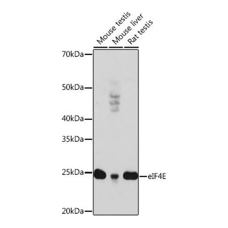 Merck Anti-eIF4E antibody produced in rabbit