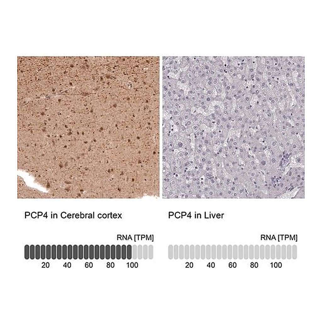 Merck Anti-PCP4 antibody produced in rabbit