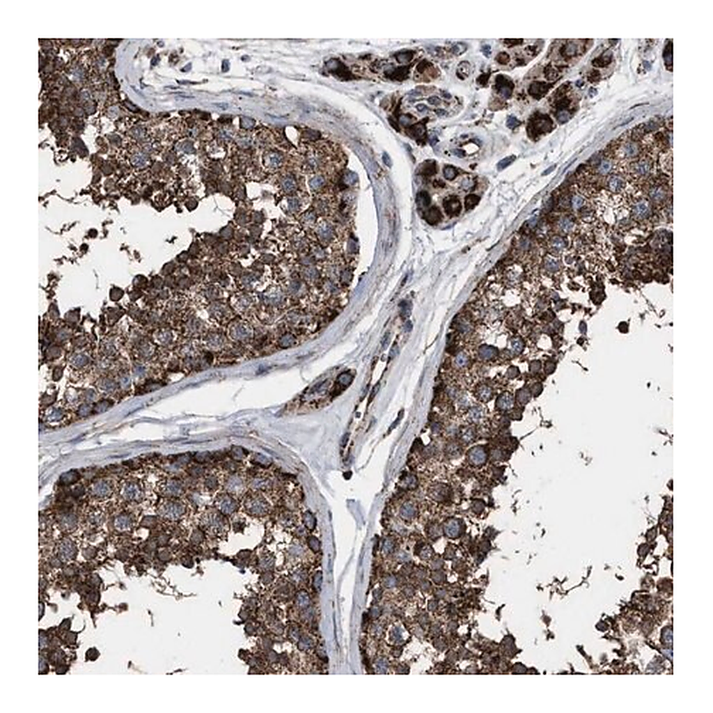 Merck Anti-VPS13A antibody produced in rabbit