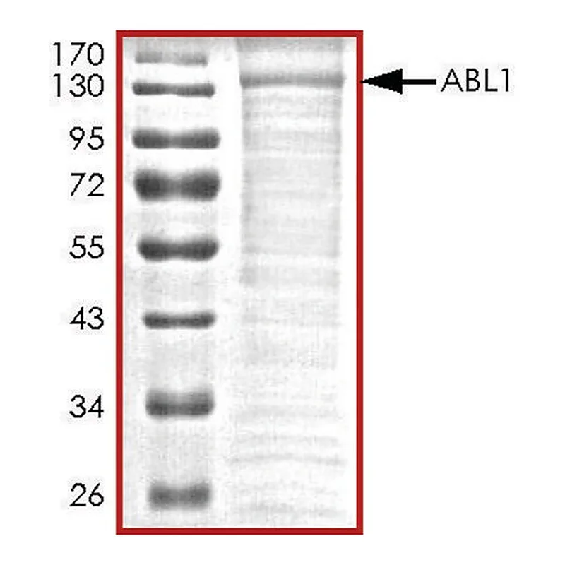 Merck ABL1, active, His tagged human