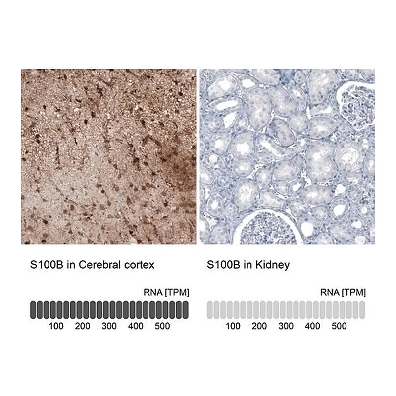 Merck Monoclonal Anti-S100B antibody produced in mouse