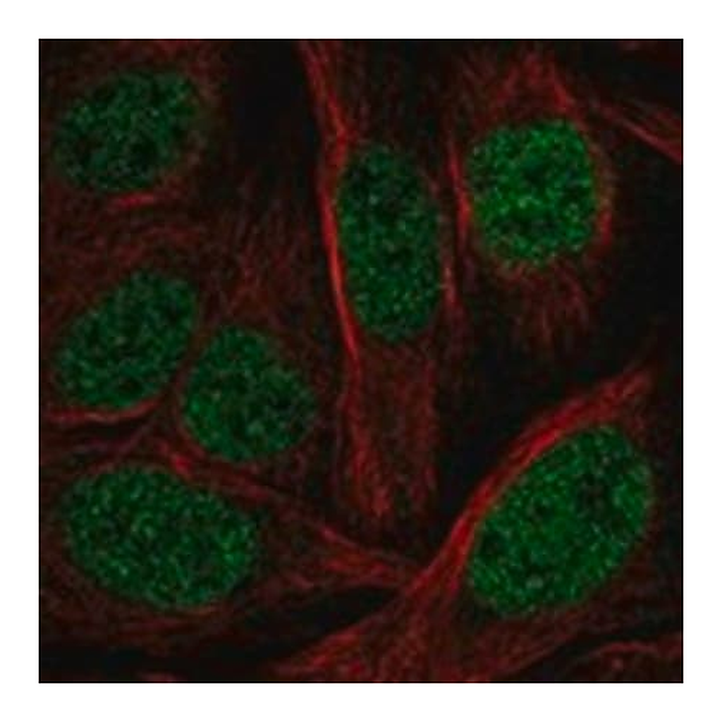 Merck Anti-PHF21A antibody produced in rabbit