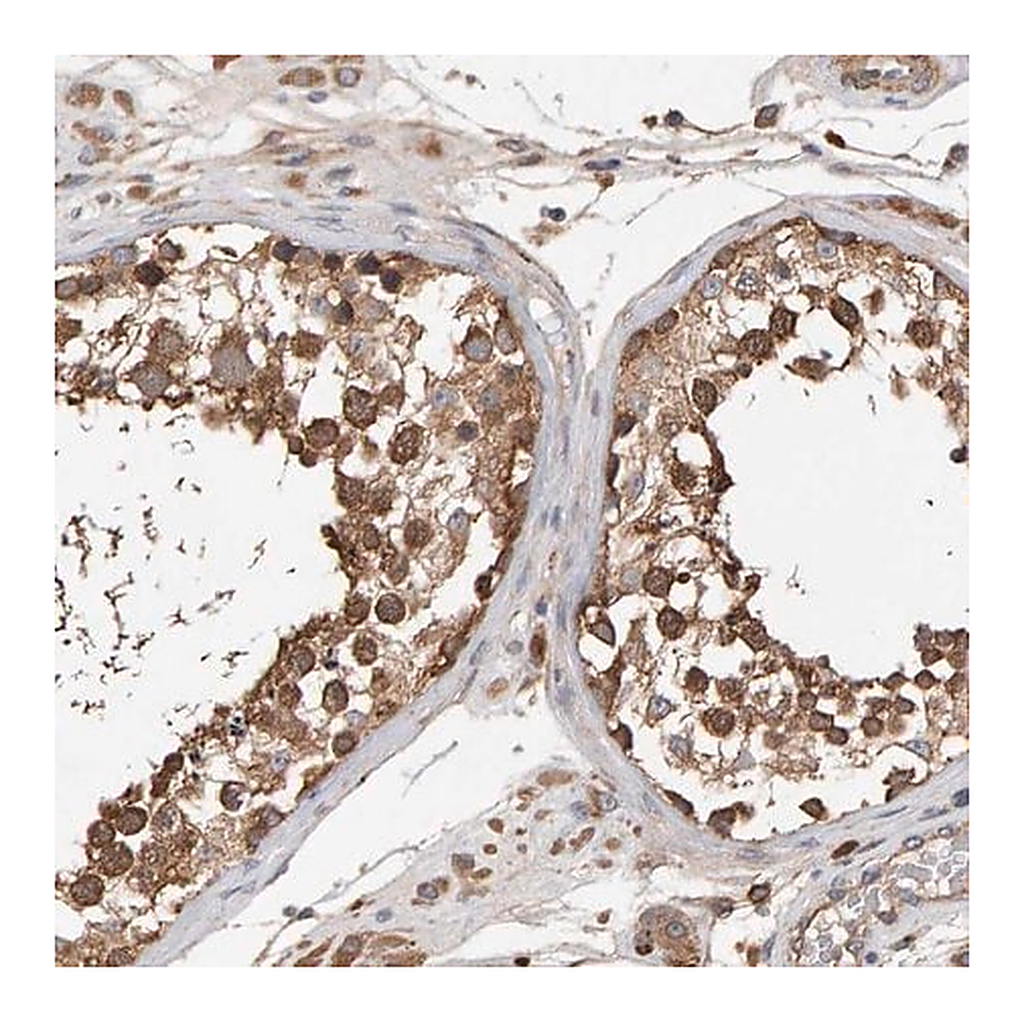 Merck Anti-RNF19A antibody produced in rabbit