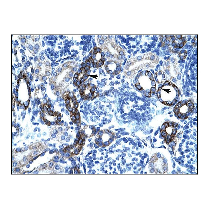 Merck Anti-BTG2