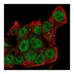 Atlas Antibodies Anti-SIAH2 Antibody
