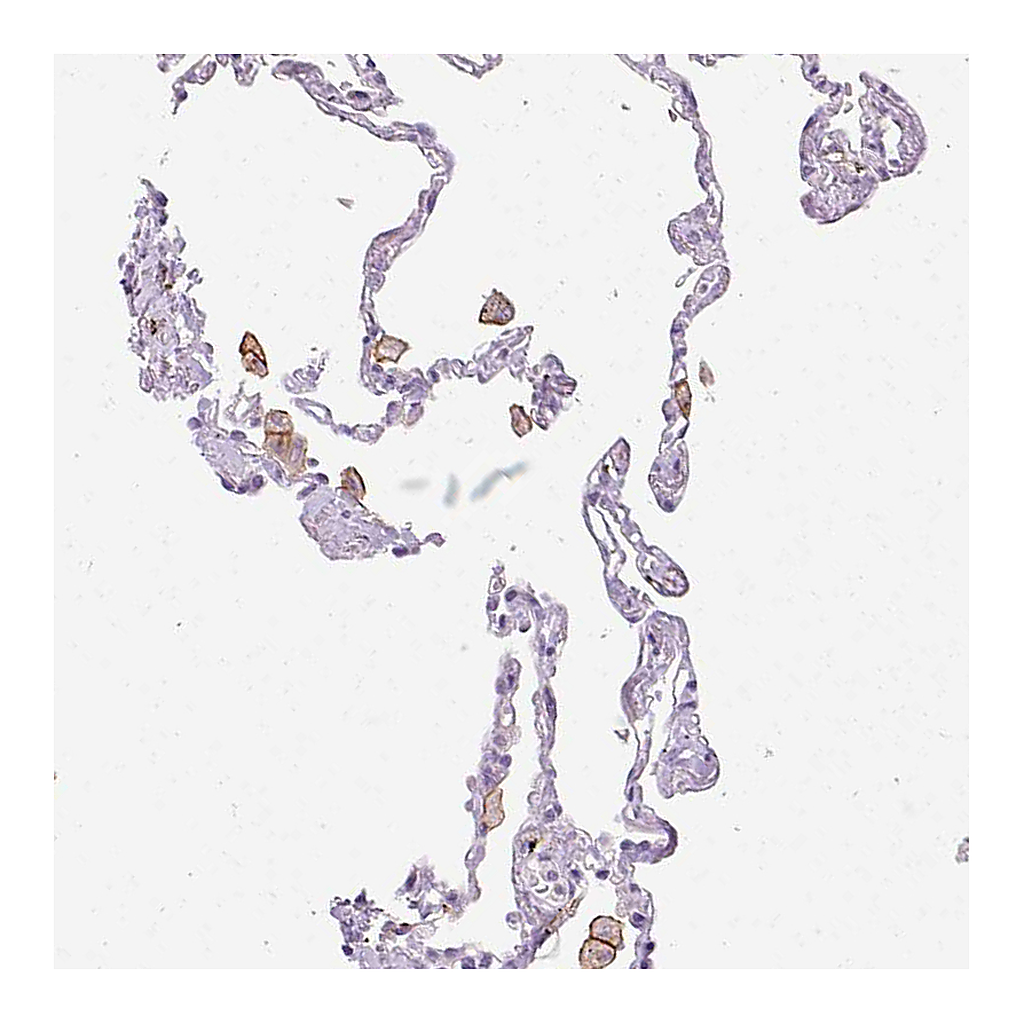 Atlas Antibodies Anti-SIGLEC1 Antibody