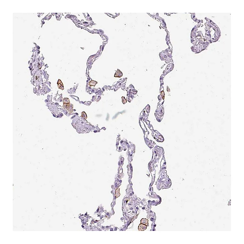 Atlas Antibodies Anti-SIGLEC1 Antibody