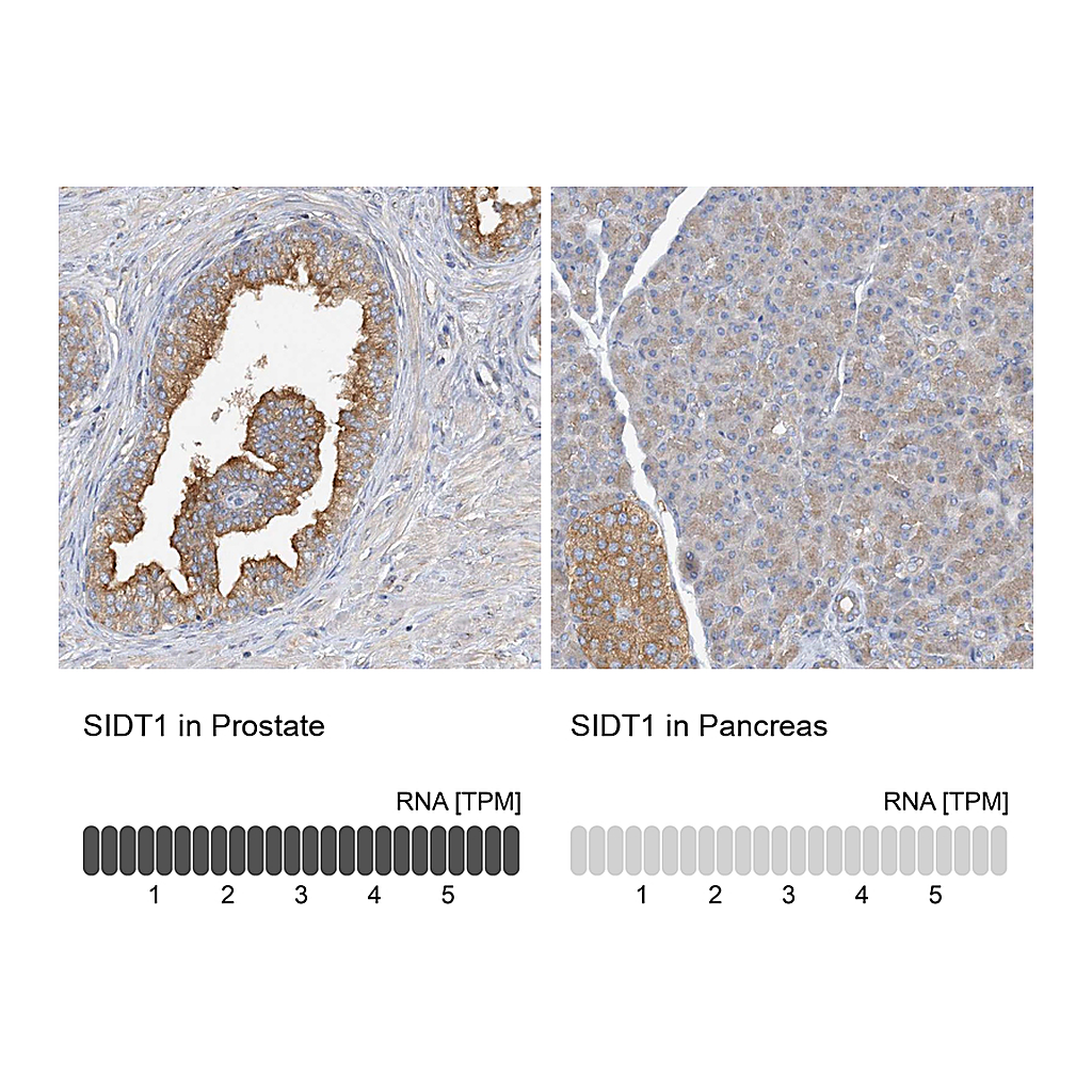 Atlas Antibodies Anti-SIDT1 Antibody