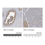 Atlas Antibodies Anti-SIDT1 Antibody
