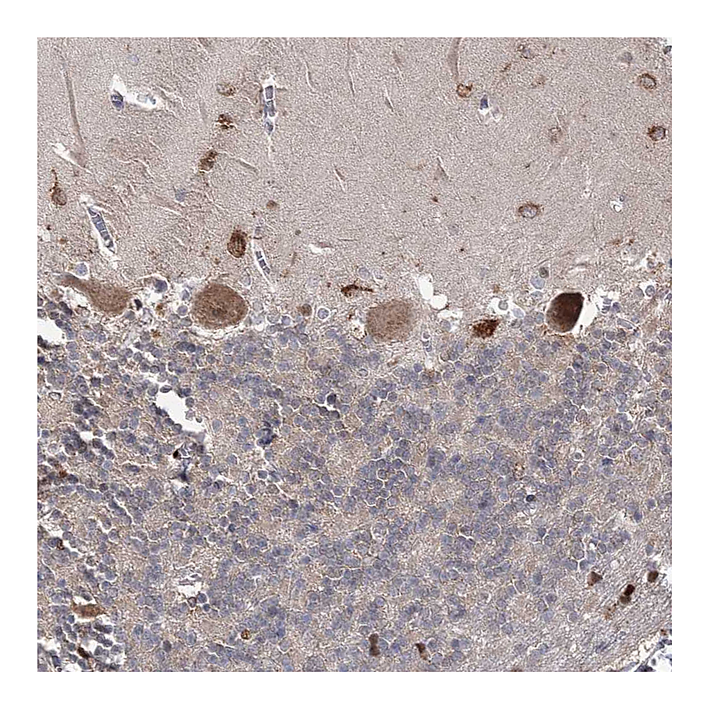 Atlas Antibodies Anti-SIAE Antibody