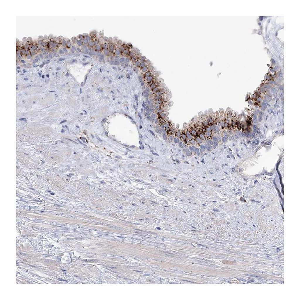 Atlas Antibodies Anti-SIAE Antibody