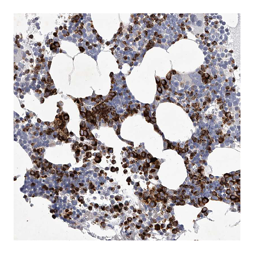 Atlas Antibodies Anti-SIGLEC10 Antibody