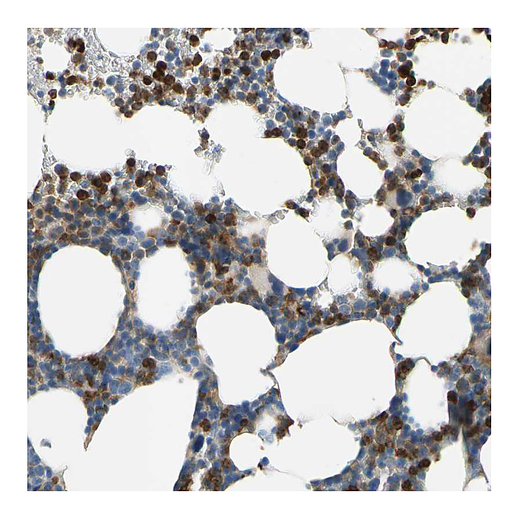 Atlas Antibodies Anti-SIGLEC5 Antibody