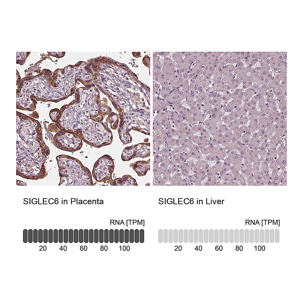 Atlas Antibodies Anti-SIGLEC6 Antibody