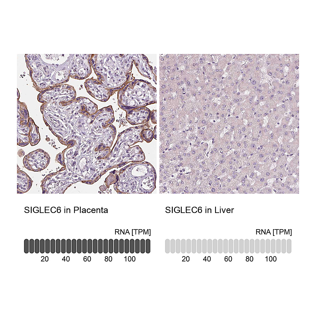 Atlas Antibodies Anti-SIGLEC6 Antibody