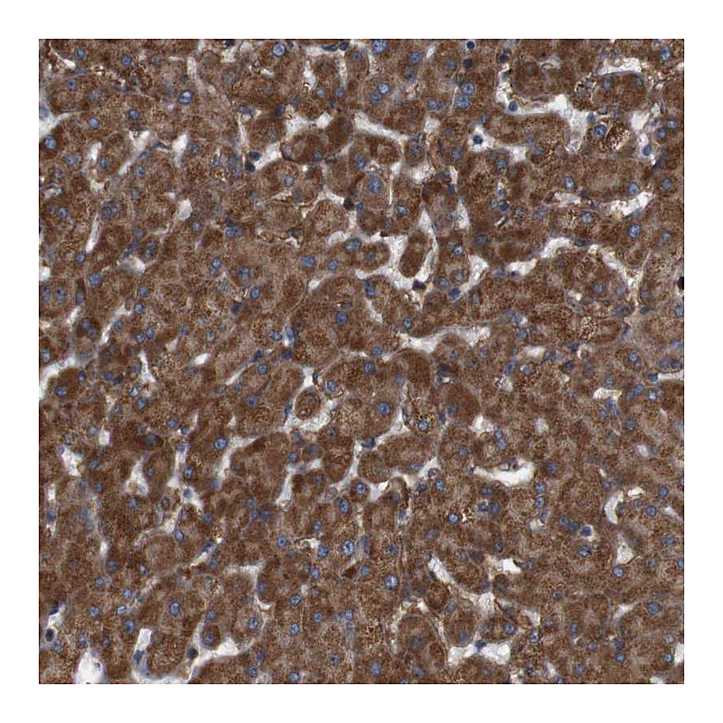 Atlas Antibodies Anti-SIGLEC8 Antibody