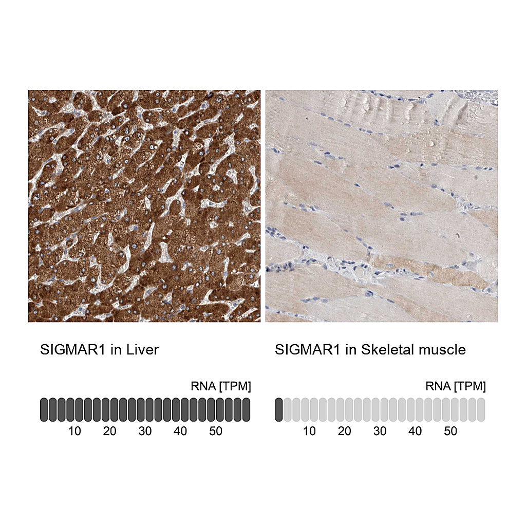 Atlas Antibodies Anti-SIGMAR1 Antibody