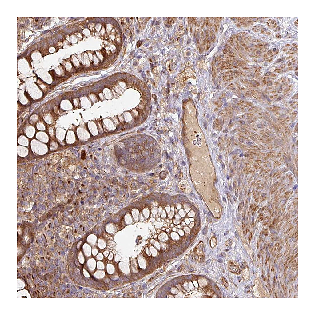 Atlas Antibodies Anti-SIK1 Antibody
